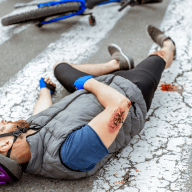 Hombre tirado en el piso por lesion por accidente de tansito